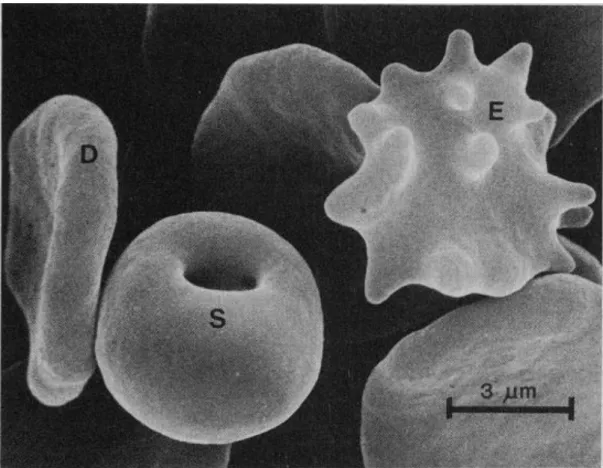 Figura 5. Eletromicrografia de diferentes formas de eritrócitos; discoide (D), estomatócito (S)  e equinócito (E)