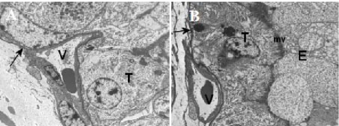 Figure  3.  A)  Electromyography  of  the  trophoblast-mesenchymal  transition  of  a  group  2  bovine  placentome