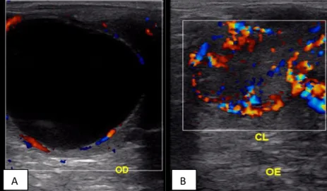 Figura  1.  Imagens  ultrassonográficas  com  Doppler  colorido  de  folículo  (A)  e  de  corpo  lúteo  (B),  para  análise de perfusão em éguas