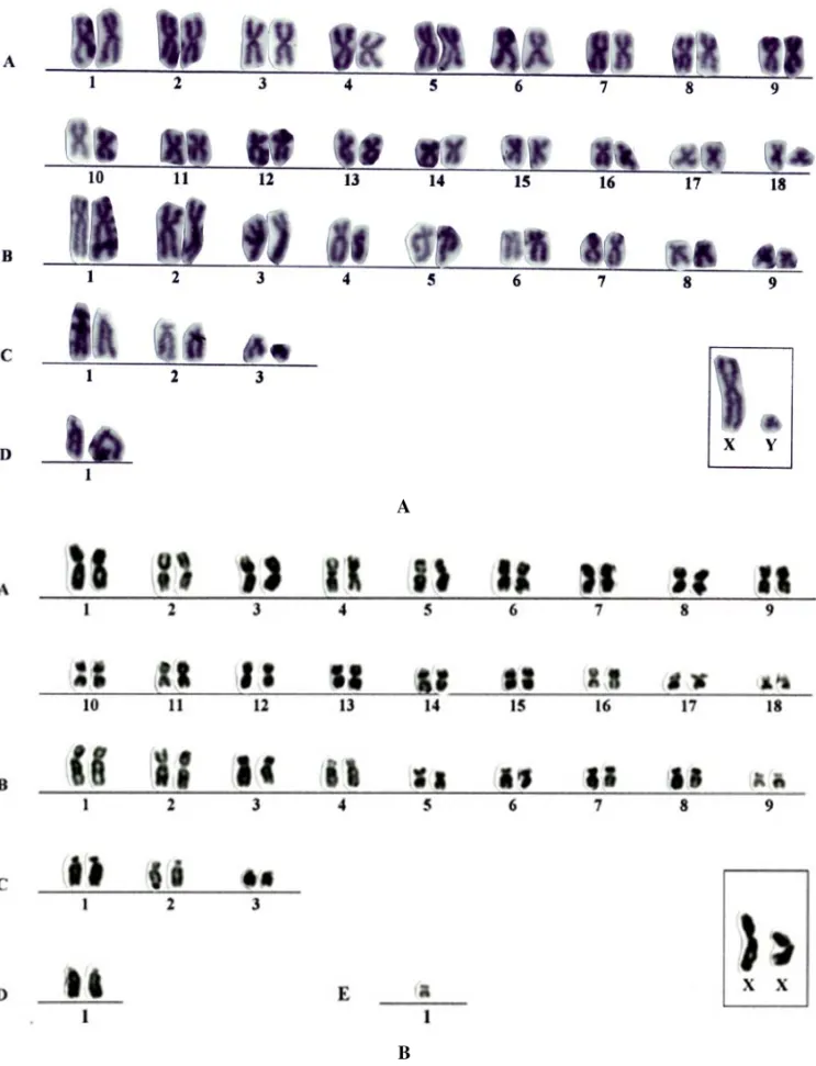 Fig. 2 – Karyotype of the lineage 2n=64 (marrow bone) and 2n=65 (lymphocytes culture) of D