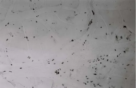 Figura 7 Fotografia de microscopia óptica de um corte transversal  do músculo gastrocnemius de um animal do grupo exercitado,  injectado com 20 mg de BrdU, onde é evidente a grande  quantidade de núcleos marcados quer no interstício quer na  periferia das 