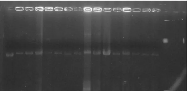 Figura 5 -  Perfil eletroforético das amostras de DNA extraídas dos 15 fagos aleatórios