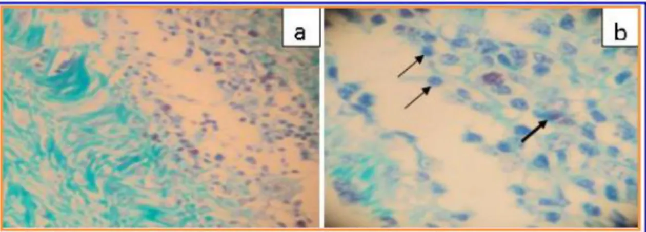 Figure 1. Photomicrographies of chitosan/PEO sample removed from Wistar rats sample seven days post- post-implantation