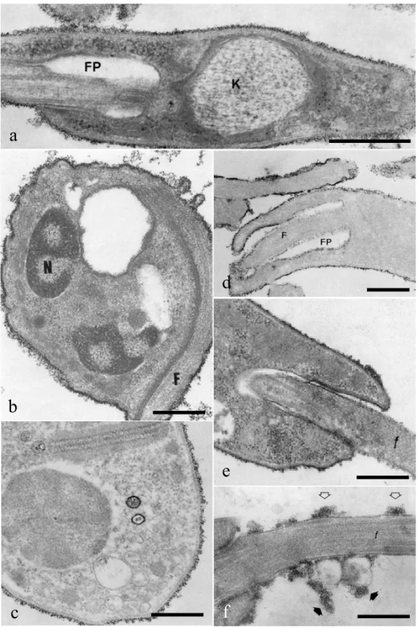 Fig. 1 – Binding of cationic particles to the surface of Trypanosoma cruzi (a-c) and Leishmania mexicana amazonensis (d-f)