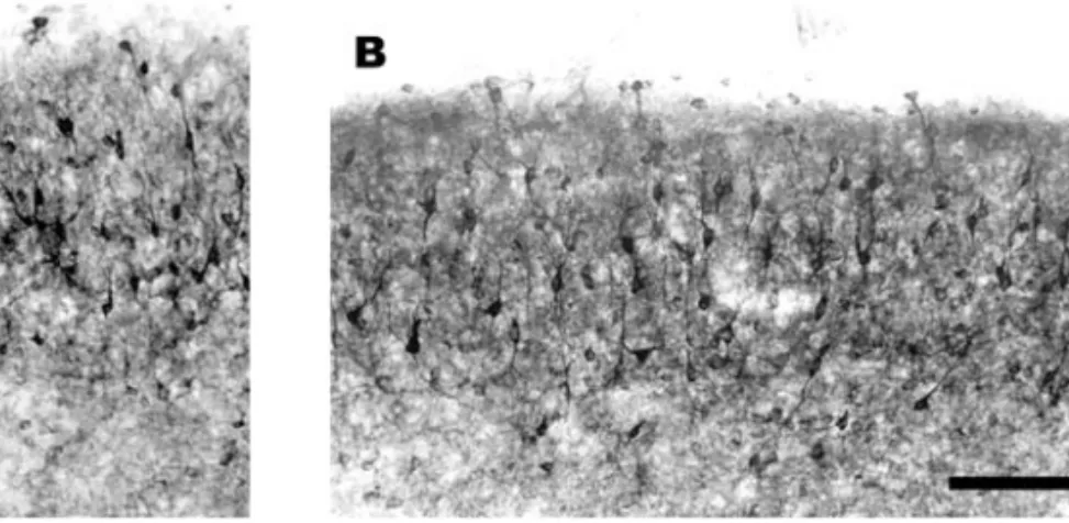 Fig. 1 – Photomicrograph of the superior colliculus of an animal P31 whose cortex was removed at P0