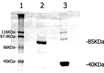 Fig. 1 – SDS-PAGE of purified rabbit muscle phosphofructoki- phosphofructoki-nase and purified chicken F-actin