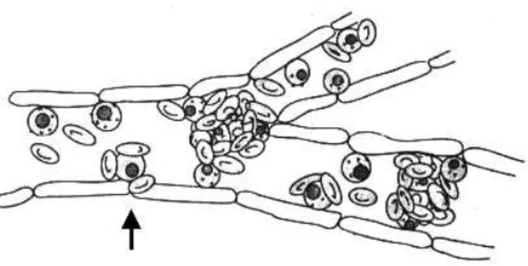Fig. 2 – Schematic representation of rosetting and cytoadherence leading to vessels obstruction.