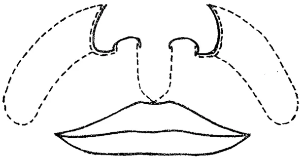Figura 4: Desenho esquemático dos retalhos nasolabiais proposto por Farina. 