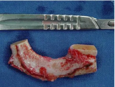 Figura 8: Fotografia demonstrando a cartilagem costal após a retirada. 