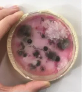 Figura 2 – Caixa de Petri com fungos (mão suja) 