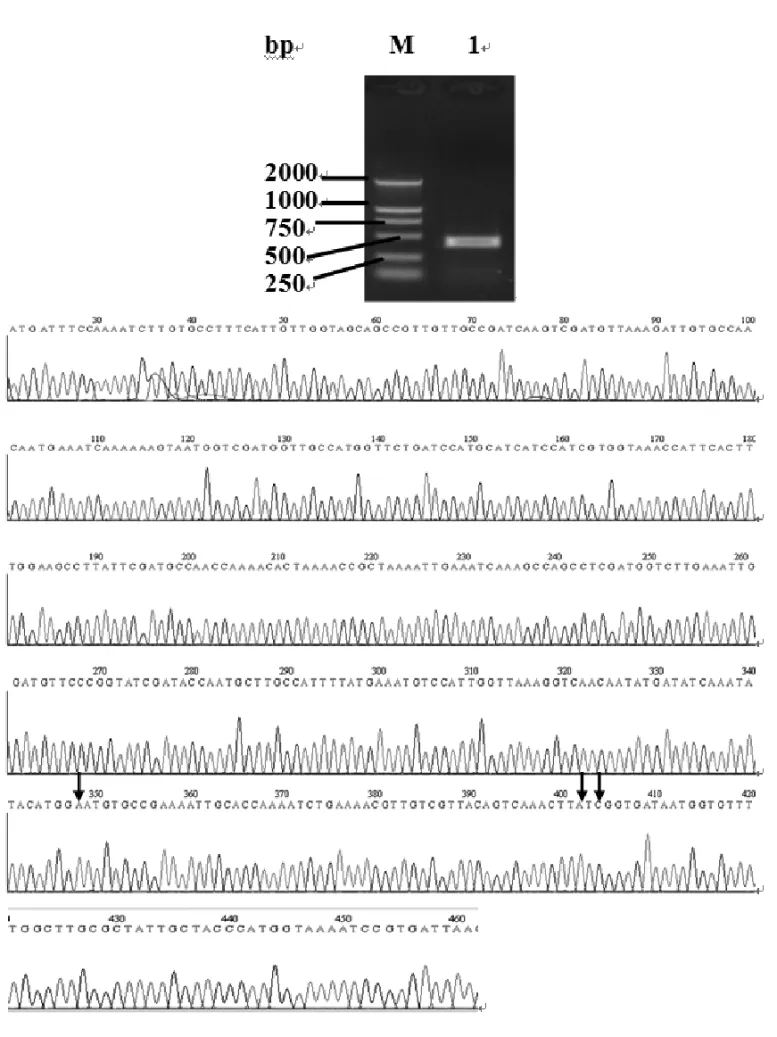Fig. 1 – Cloning and sequencing of cDNA encoding Der f 2. (A) Amplification of the cDNA encoding for Der f 2 protein by RT-PCR