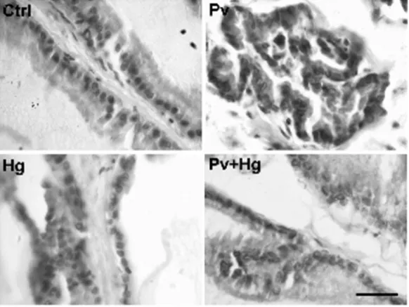 Fig. 4 – Prostate histology. Histological changes obtained after denervation of pelvic (Pv) and hypogastric (Hg) nerves alone or in combination (Pv+Hg)