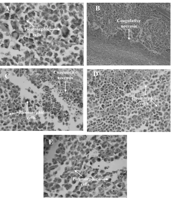 Fig. 1 – Histopathology of tumors excised from Sarcoma 180 transplanted mice after 7 days of intraperitoneal treatment with Calotropis procera stem extracts at the dose of 250 mg/kg/day (C – ethyl acetate; D – acetone; E – methanol)