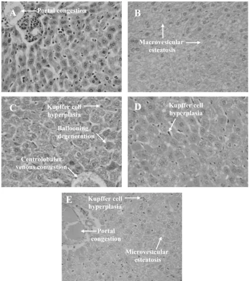 Fig. 2 – Histopathology of livers excised from Sarcoma 180 transplanted mice after 7 days of intraperitoneal treatment with Calotropis procera stem extracts at the dose of 250 mg/kg/day (C – ethyl acetate; D – acetone; E – methanol)