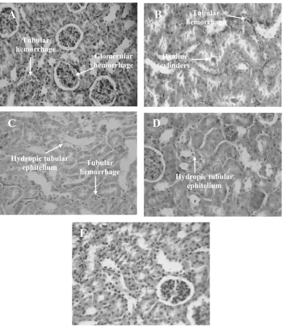 Fig. 3 – Histopathology of kidneys excised from Sarcoma 180 transplanted mice after 7 days of intraperitoneal treatment with Calotropis procera stem extracts at the dose of 250 mg/kg/day (C – ethyl acetate; D – acetone; E – methanol)