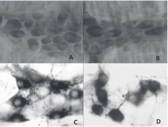 Figure  1  -  Duodenal whole mounts evidencing myenteric plexus ganglions: Giemsa. A) Control Group; B)  Malnourished Group