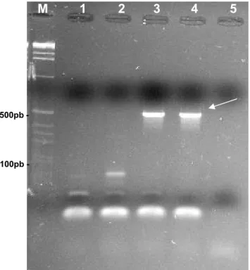 Figura  2 –  Fragmentos  de  513  pb  do  gene  mecA  (seta),  de  cepas  de  Staphylococcus  aureus isoladas dos CVC de pacientes do CTI do Hospital  Escola  da  UFTM,  Uberaba/MG,  2007