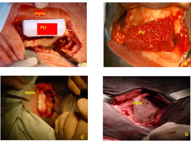 Fig. 3.13. A) Sutura cutânea da tíbia. B) Sutura cutânea do ilíaco. 