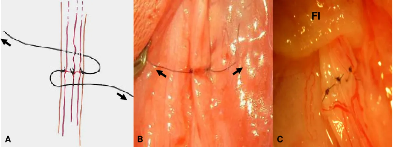 Figura 2. A. Esquema representativo da rotação do ramo bucal dorsal do nervo facial com pontos de  sutura para visualização da face  medial