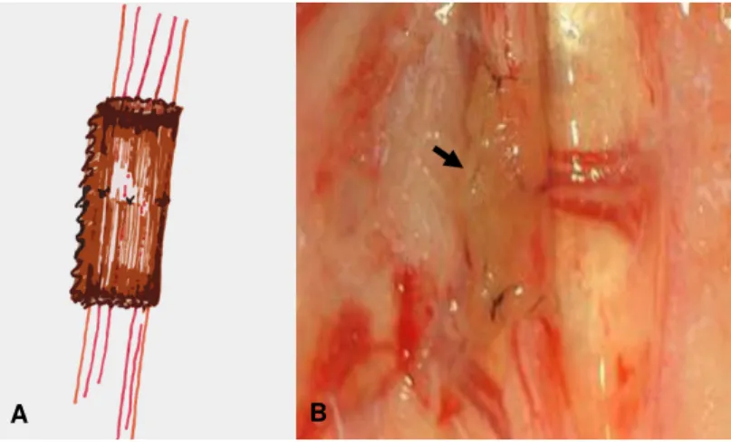 Figura 3. A. Esquema representativo do tubo-guia intestinal de jejuno alógeno fixado no ramo bucal  dorsal  do  nervo  facial