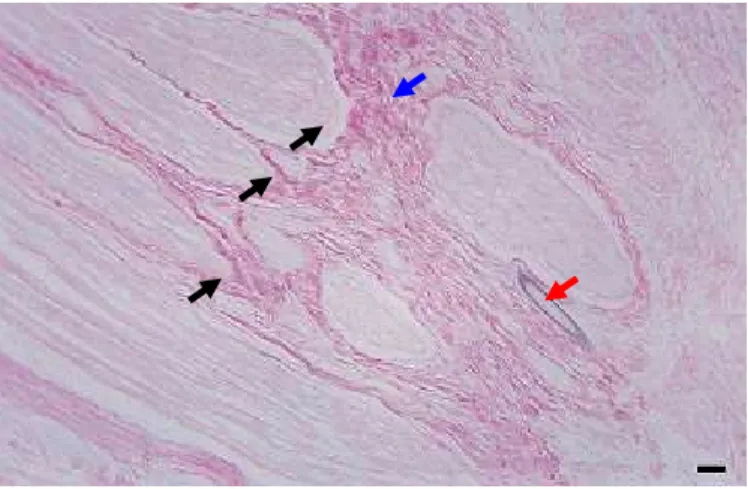Figura 7. Fotomicrografia da reparação do ramo bucal dorsal do nervo facial de coelho da raça Nova  Zelândia  com  tubo-guia  intestinal  de  jejuno  alógeno  aos  15  dias  de  PO