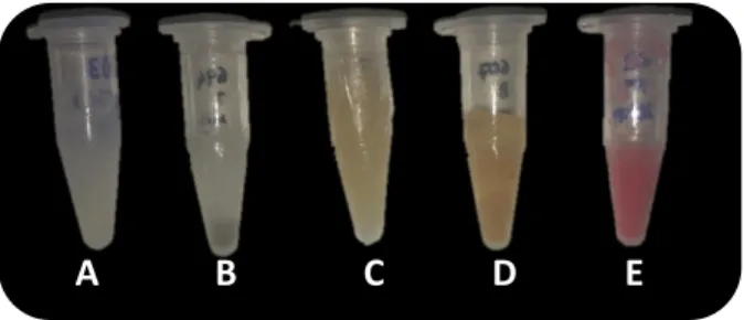 Figure 7- Saliva samples with visible impurities. Sample  A-sample  with  normal  appearance;  Sample  B-  agglomerate  of  food  particles  and  other  impurities; 