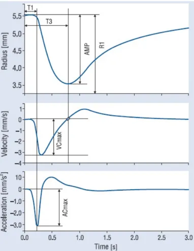 Figura 2.2: Parˆametros medidos em um ciclo pupilar: latˆencia (T1), m´axima velocidade de constri¸c˜ao (VCmax), tempo para a m´axima constri¸c˜ao (T3), amplitude (AMP), raio inicial (R1), raio m´ınimo (R2) e m´axima acelera¸c˜ao de constri¸c˜ao(ACmax).