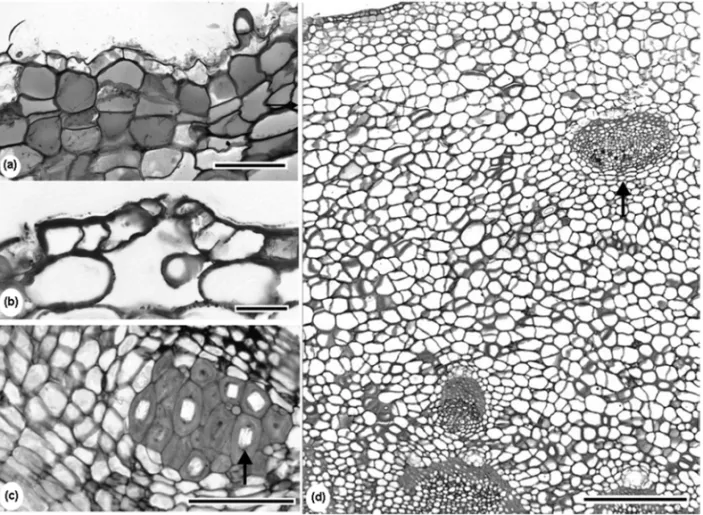 Fig. 4 – Stem tuber of Trixis nobilis (Vell.) Katinas with protective tissue constituted by cortical parenchyma cell layers containing phenolic compounds (a) and epidermis with stoma (b)