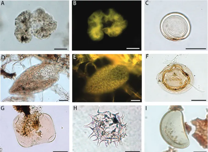 Fig. 4  - Palynomorph group. A-B,  Botryococcus; C, Pseudoschizaea ; D-E,  Spyrogira; F, Debaria; G, Mougeotia; H, Desmídia; 