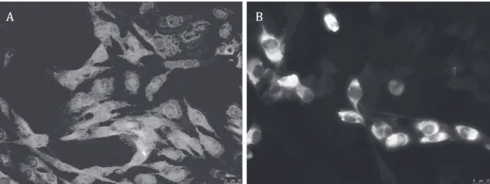 Figure 2 -  Transcript-derived L-IC-DENV3 L42 protein expression in BHK-21 cells analyzed by immunofluorescence assay  (IFA)