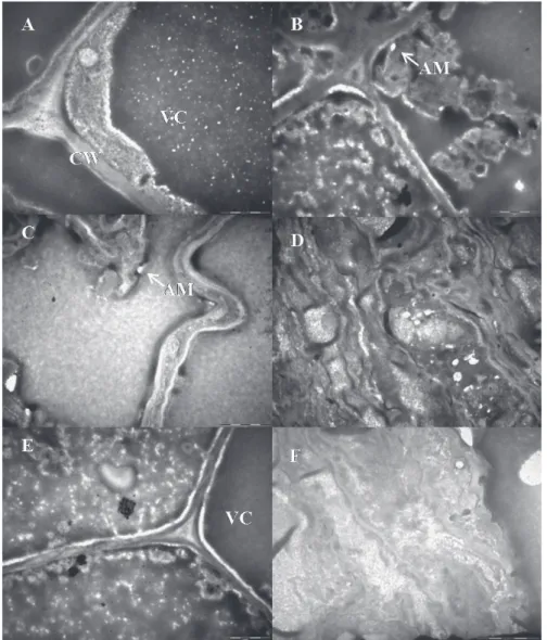 Fig. 5 - Images  of  meristematic  cells  obtained  by  Transmission  Electron  Microscopy  of  Cedrela  fissilis  germinated  seeds  with  1(A),  2  (C)  and  5  (E)  mm  long  radicle  before  dehydration