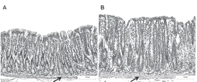 Figure 1 - Effect of food restriction on colonic mucosa. (A) Tunica mucosa of the proximal colon in control rats  (C group); and (B) food-restricted rats (FR group)