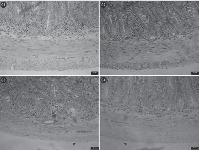 Figure 3 - Photomicrographs of jejunal muscular layer of rats submitted to protein restriction and supplemented with probiotics