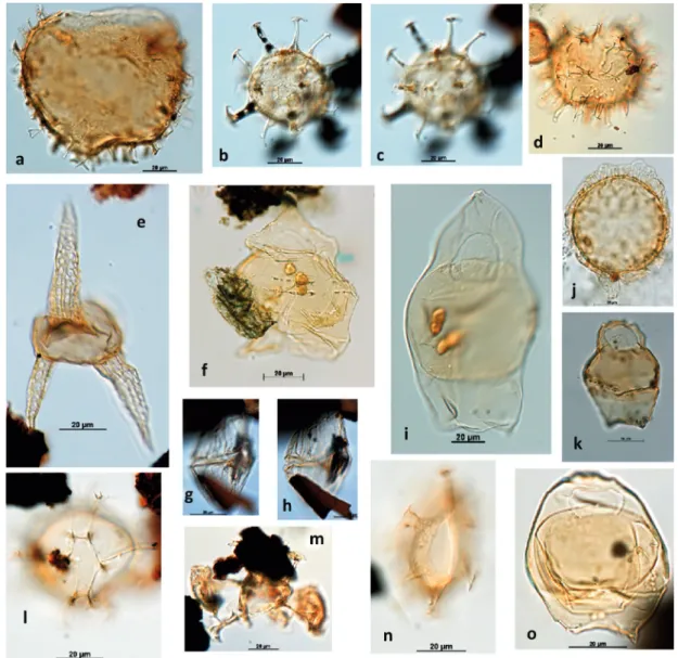 Figure 3 - The relevant dinocysts identified in the studied section: a) Cyclonephelium sp.; b-c) Oligosphaeridium sp.; 