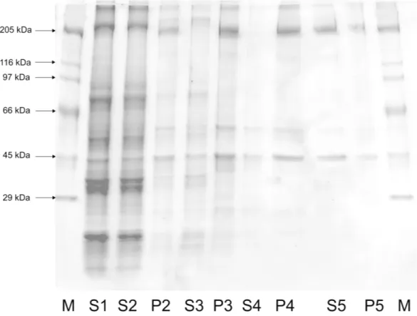 Figura  3:  SDS-PAGE  da  larva de P. nucleorum  Aproximadamente 10 µg de P4,  S5  e  P5  foram  aplicad massa  molecular:  miosin ovalbumina e anidrase carb