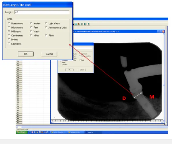 Figura  2:      Calibração  prévia  do  programa  Image  Tool  para  posterior  mensuração (Implante inclinado)