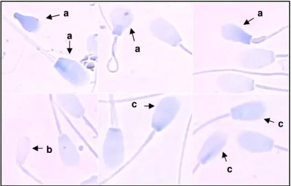 Figura 2.  Esfregaço  de sêmen  bovino  corado com  Azul  de Toluidina, com morfologia alterada  e anomalias  de  cromatina  (a),  morfologia  alterada  e  cromatina  normal(b)  e  morfologia  normal  e  anomalias  de  cromatina (c)