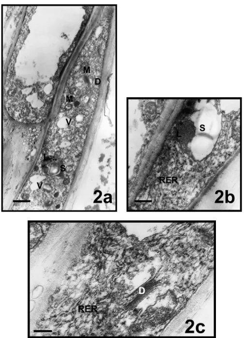 Fig. 2 – Subapical zones of pollen tubes in Mimulus aurantiacus. a, bar = 1, 5µm;