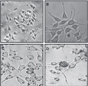 Figure 2 -   Aβ-induced  morphological  changes  in  PC12  cells. 