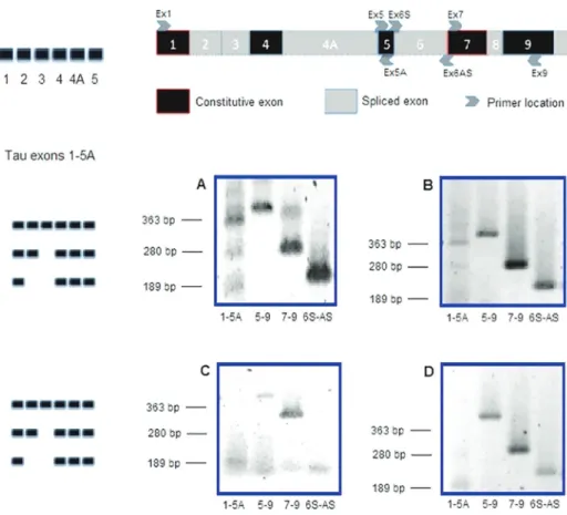 Figure 3 -  Representations of protein tau, exons 1 to 9 (modified from Vanier et al. 1998) and the  exons 1 to 5 comprised in the region amplified by primer pair Ex1/Ex5A