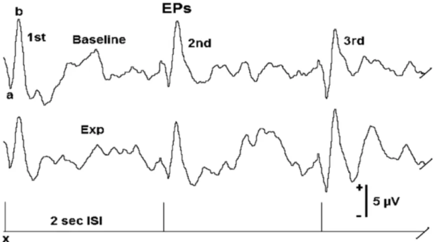 Figure 1 - Example of the first three P2 waves of the evoked potentials (EPs) recorded before (Baseline) and after (Exp) a subject  received the drink in the alcohol group