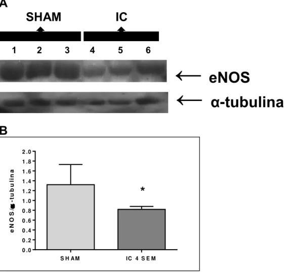 Figura 7: Expressão proteica de eNOS em corpo cavernoso de ratos controle (SHAM) e  ratos  submetidos  à  indução  da fístula  aortocaval  (IC)