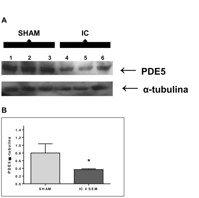 Figura 9: Expressão proteica de PDE5 em corpo cavernoso de ratos controle (SHAM) e  ratos  submetidos  à  indução  da fístula  aortocaval  (IC)