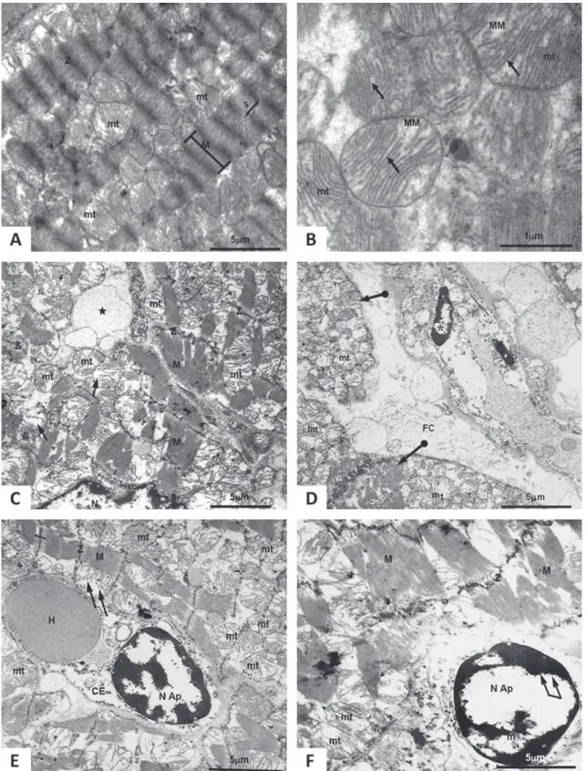 Fig. 3 - Transmission electron microscopy. (A) and (B) Control group; (C), (D), (E) and (F) Irradiated group.