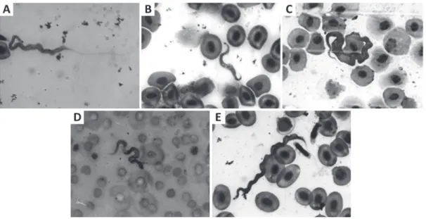Figure 1 - Types of Trypanosomes found in some host species (A,  Cochliodon sp.; B,  Lasiancistrus  saetiger; C, Leporacanthicus galaxia; D, Pseudacanthicus spinosus; E, Cochliodon sp.)