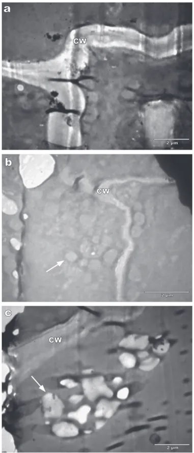 Figura 9 - Transmission electron micrographs of the callus Type 4. A) Thin cell wall. B) Numerous mitochondria (arrows) and  C) amyloplasts (arrows)