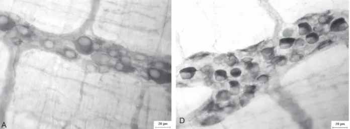 Figure 2 - Micrographs of the myenteric plexus of the ileum of rats showing myenteric ganglia stained by myosin-V belonging  to animals from the groups: untreated normoglycaemic (A), L-glutamine-treated normoglycaemic (B), untreated diabetic (C),  L-glutam