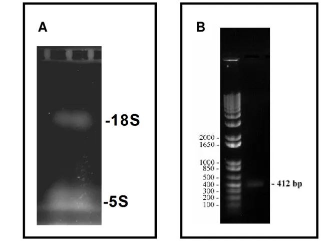 Figura 2.  Obtenção de RNA total de B. tropicalis e gene de Blo t 5.  (A) RNA total de  Blomia tropicalis  em gel de agarose para RNA apresentando as bandas 18S e 5S