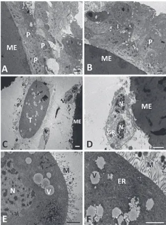 Figure 10 - Fat body of Diatraea flavipennella non-parasitized  (A and B) at 3 days (C and D) and 9 days (E and F) of parasitism  by Cotesia  flavipes