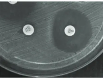 figure 2 - Electrophoresis gel signifying amplified  mecA (533  bp), ermA  (421 bp) and  ermC (572 bp) genes from the same strain